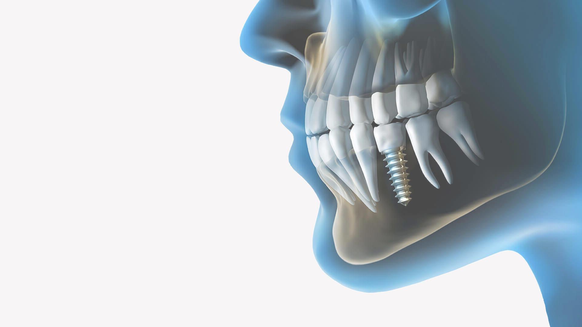 ToothCare dental care